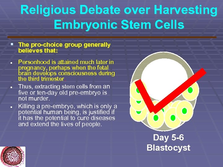 Religious Debate over Harvesting Embryonic Stem Cells The pro-choice group generally believes that: Personhood
