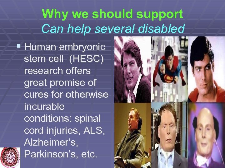 Why we should support Can help several disabled Human embryonic stem cell (HESC) research