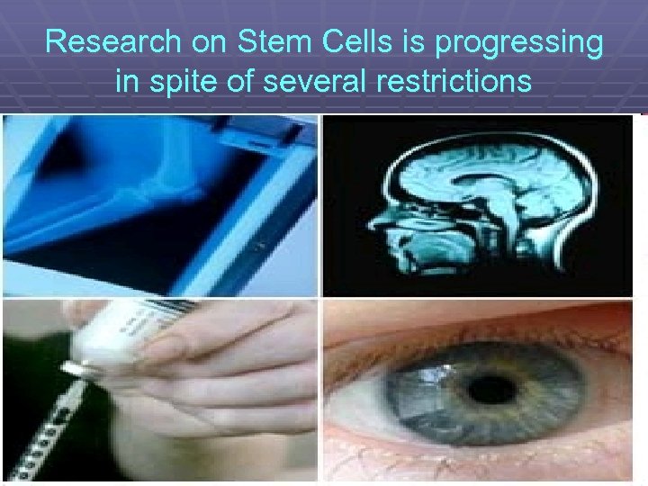 Research on Stem Cells is progressing in spite of several restrictions 