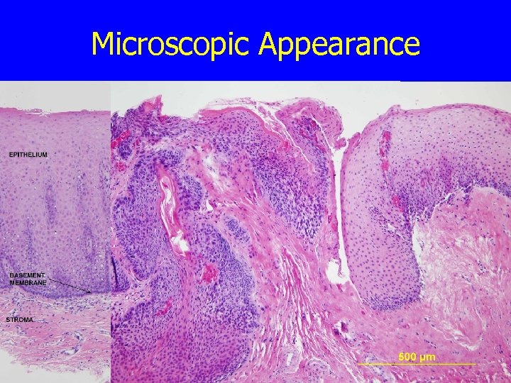 Microscopic Appearance 