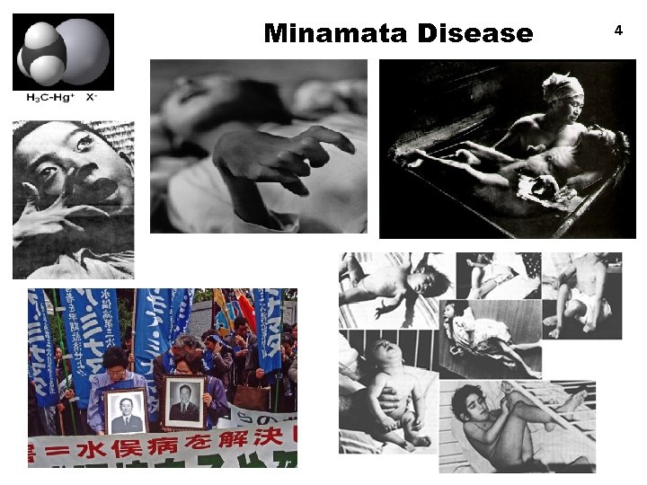 Minamata Disease 4 