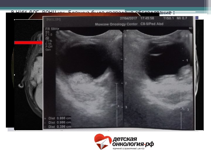 В НИИ ДОГ РОНЦ им. Блохина было проведено обследование : Вид обследования: Заключение: Офтальмологический