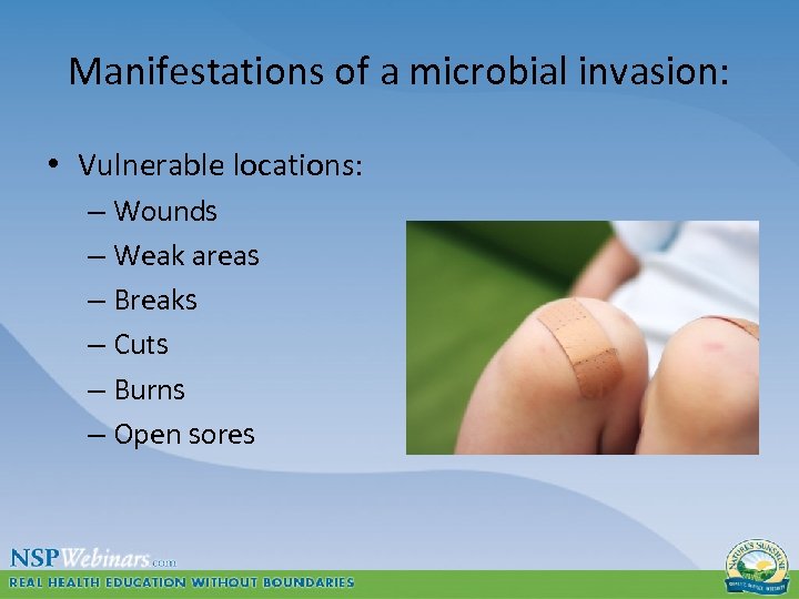 Manifestations of a microbial invasion: • Vulnerable locations: – Wounds – Weak areas –