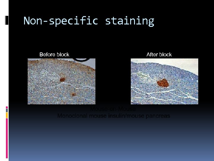 Non-specific staining Before block After block 