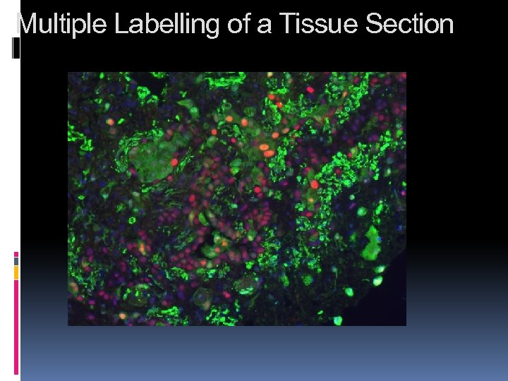 Multiple Labelling of a Tissue Section 