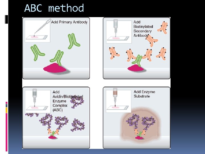 ABC method 