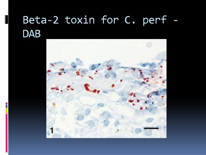 Beta-2 toxin for C. perf DAB 