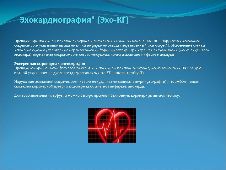  Эхокардиография