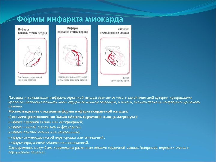 Формы инфаркта миокарда Площадь и локализация инфаркта сердечной мышцы зависят от того, в какой