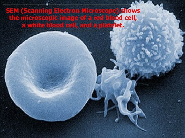 SEM (Scanning Electron Microscope) shows the microscopic image of a red blood cell, a
