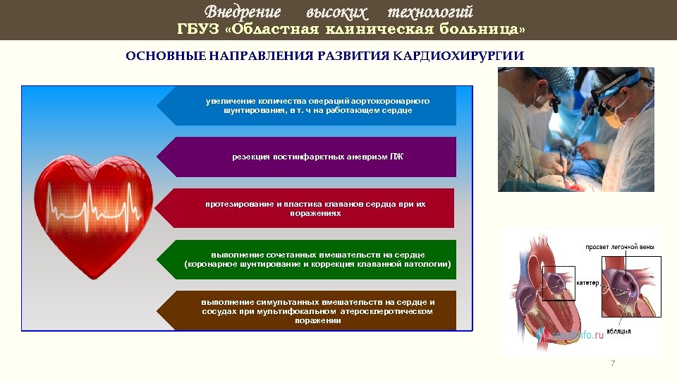 Внедрение высоких технологий ГБУЗ «Областная клиническая больница» ОСНОВНЫЕ НАПРАВЛЕНИЯ РАЗВИТИЯ КАРДИОХИРУРГИИ увеличение количества операций