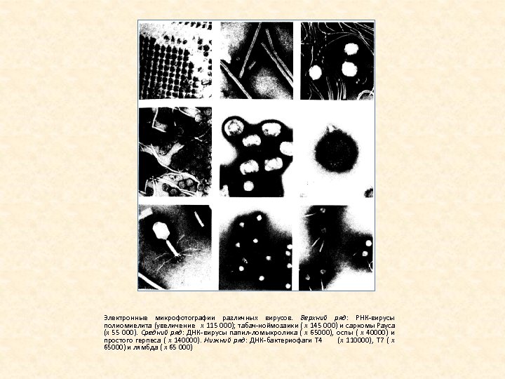 Электронные микрофотографии различных вирусов. Верхний ряд: РНК вирусы полиомиелита (увеличение х 115 000); табач