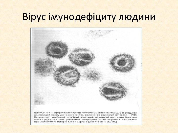 Вірус імунодефіциту людини 
