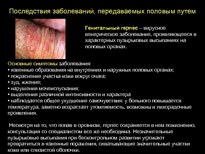 Последствия заболеваний, передаваемых половым путем Генитальный герпес – вирусное венерическое заболевание, проявляющееся в характерных