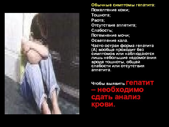 ü ü ü ü ü Обычные симптомы гепатита: Пожелтение кожи; Тошнота; Рвота; Отсутствие аппетита;