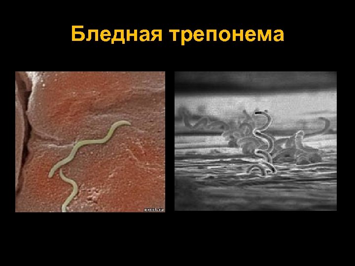 Бледная трепонема 