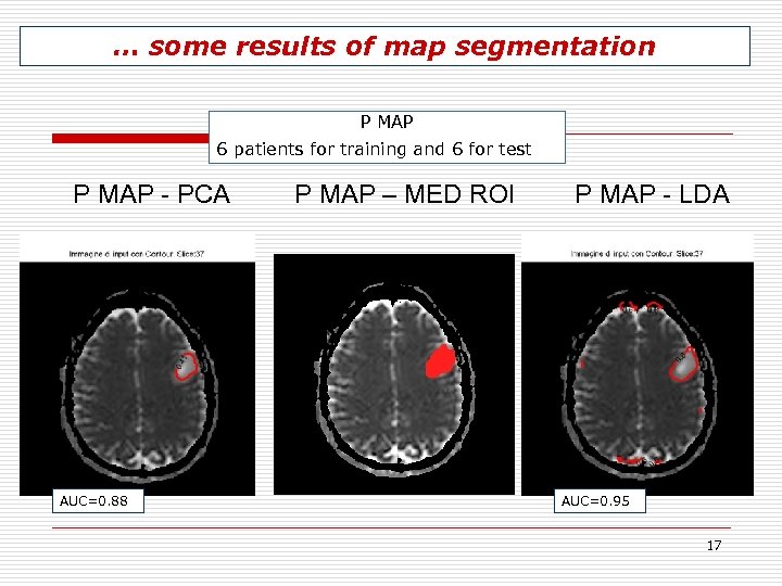 … some results of map segmentation P MAP 6 patients for training and 6