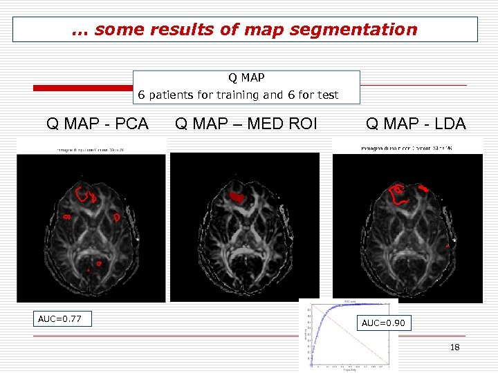 … some results of map segmentation Q MAP 6 patients for training and 6