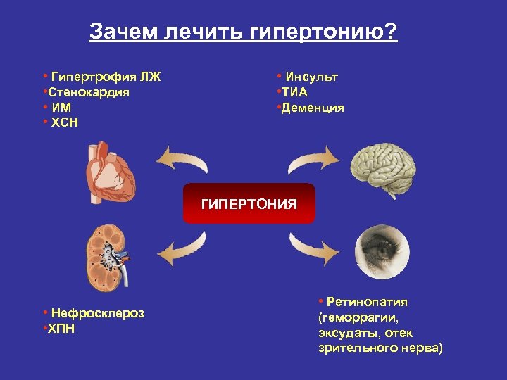 Зачем лечить гипертонию? • Гипертрофия ЛЖ • Стенокардия • ИМ • ХСН • Инсульт