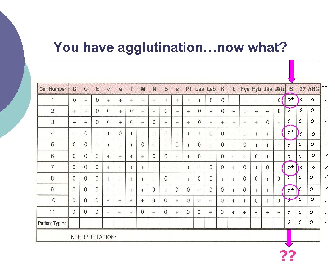 You have agglutination…now what? CC 2+ 0 0 0 0 0 0 0 0