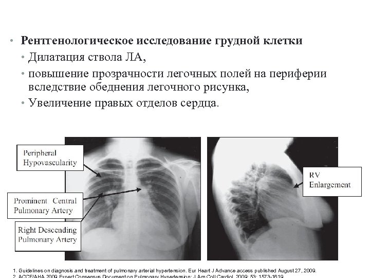 Рентгенологическое исследование грудной клетки