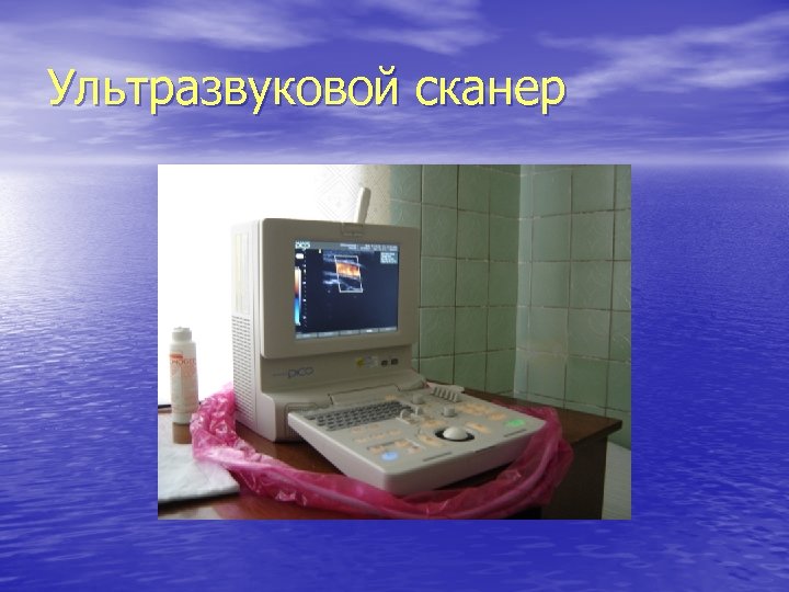 Ультразвуковой сканер 