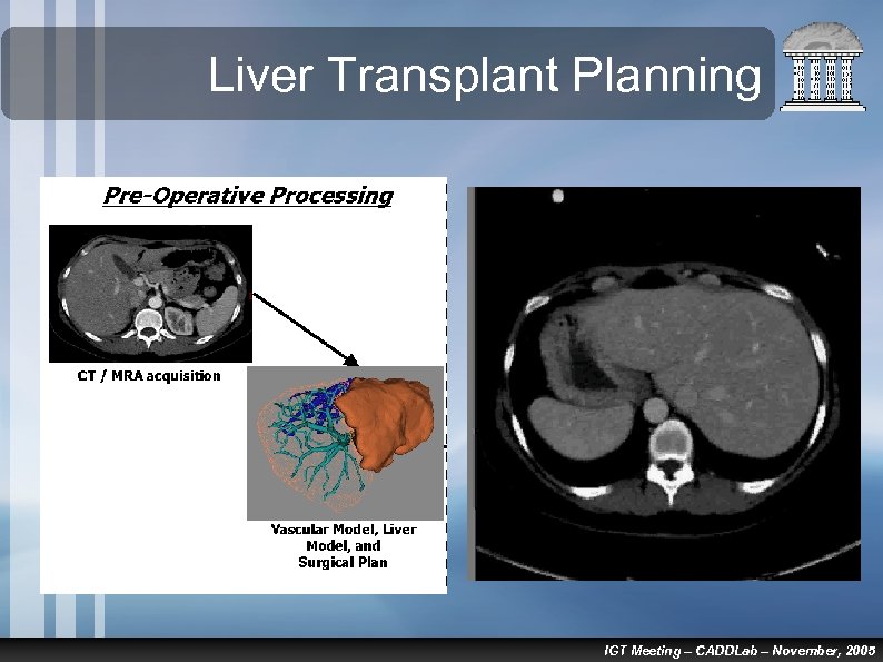 Liver Transplant Planning IGT Meeting – CADDLab – November, 2005 