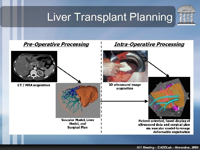 Liver Transplant Planning IGT Meeting – CADDLab – November, 2005 