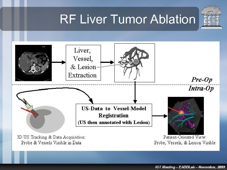 RF Liver Tumor Ablation IGT Meeting – CADDLab – November, 2005 