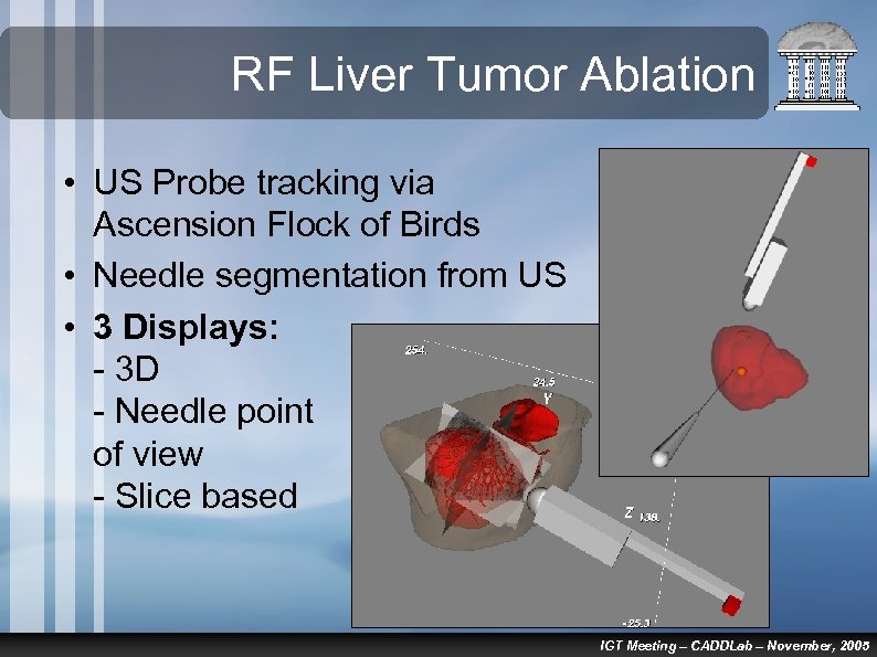 RF Liver Tumor Ablation • US Probe tracking via Ascension Flock of Birds •