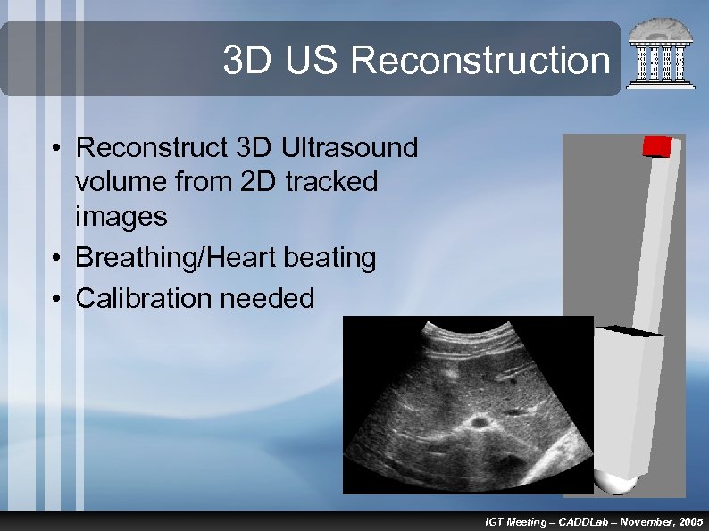 3 D US Reconstruction • Reconstruct 3 D Ultrasound volume from 2 D tracked