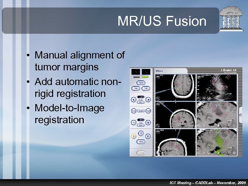 MR/US Fusion • Manual alignment of tumor margins • Add automatic nonrigid registration •