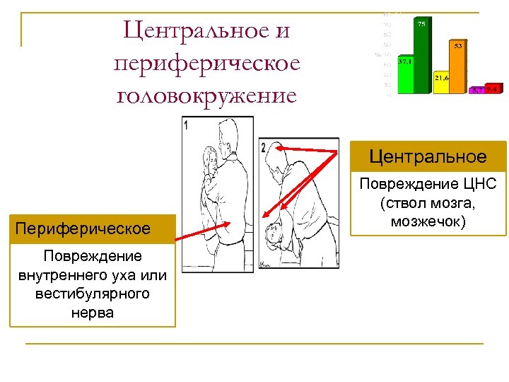 Центральное и периферическое головокружение Центральное Периферическое Повреждение внутреннего уха или вестибулярного нерва Повреждение ЦНС