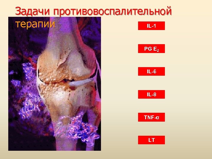Задачи противовоспалительной терапии IL-1 PG E 2 IL-6 IL-8 TNF-α LT 