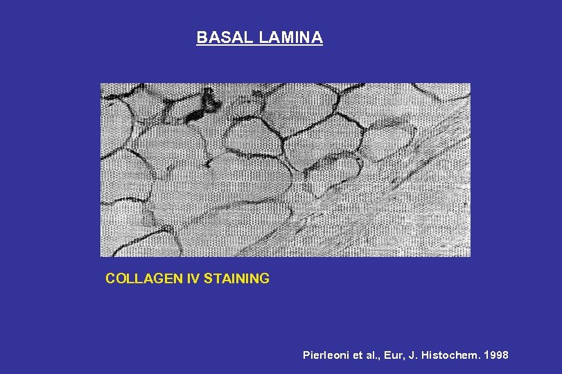 BASAL LAMINA COLLAGEN IV STAINING Pierleoni et al. , Eur, J. Histochem. 1998 