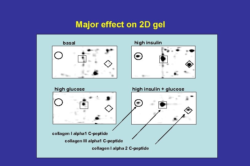 Major effect on 2 D gel high insulin basal high glucose high insulin +