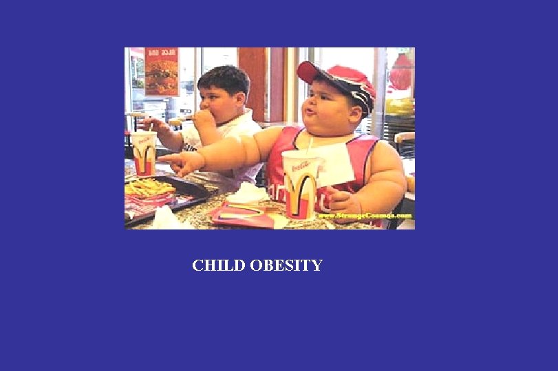 CHILD OBESITY 