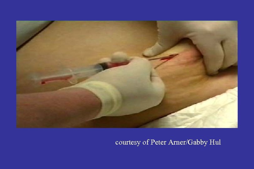 courtesy of Peter Arner/Gabby Hul 