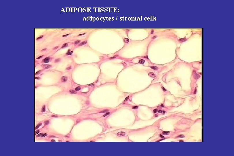 ADIPOSE TISSUE: adipocytes / stromal cells 