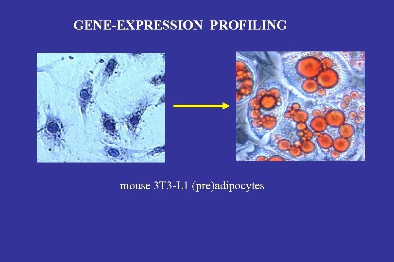 GENE-EXPRESSION PROFILING mouse 3 T 3 -L 1 (pre)adipocytes 