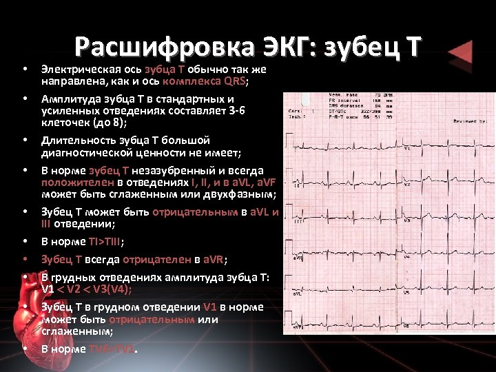  • • • Расшифровка ЭКГ: зубец T Электрическая ось зубца T обычно так