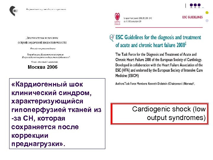  «Кардиогенный шок клинический синдром, характеризующийся гипоперфузией тканей из -за СН, которая сохраняется после