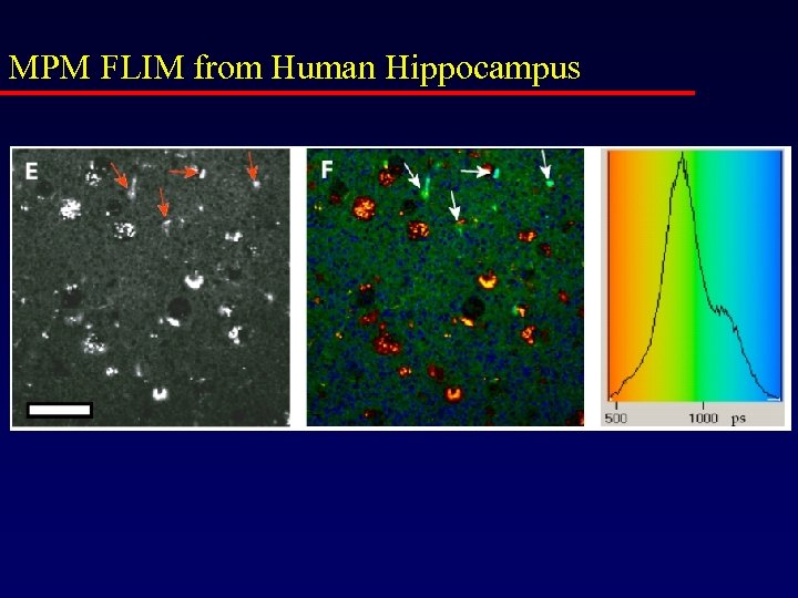 MPM FLIM from Human Hippocampus 