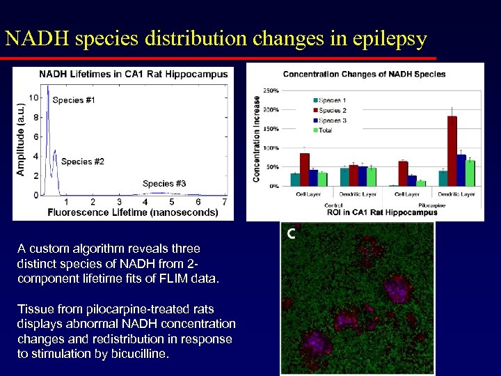 NADH species distribution changes in epilepsy A custom algorithm reveals three distinct species of