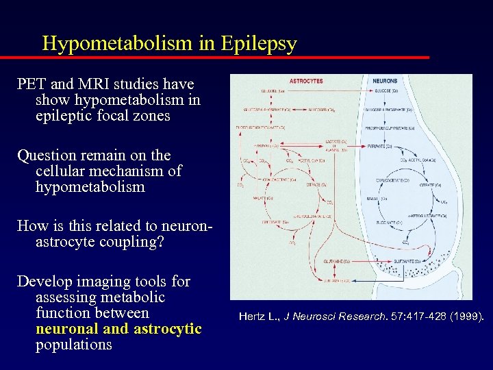 Hypometabolism in Epilepsy PET and MRI studies have show hypometabolism in epileptic focal zones