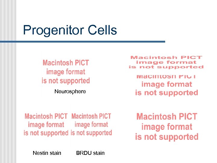 Progenitor Cells Neurosphere Nestin stain BRDU stain 