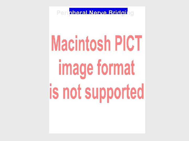 Peripheral Nerve Bridging 