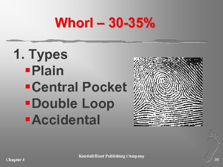 Whorl – 30 -35% 1. Types § Plain § Central Pocket § Double Loop