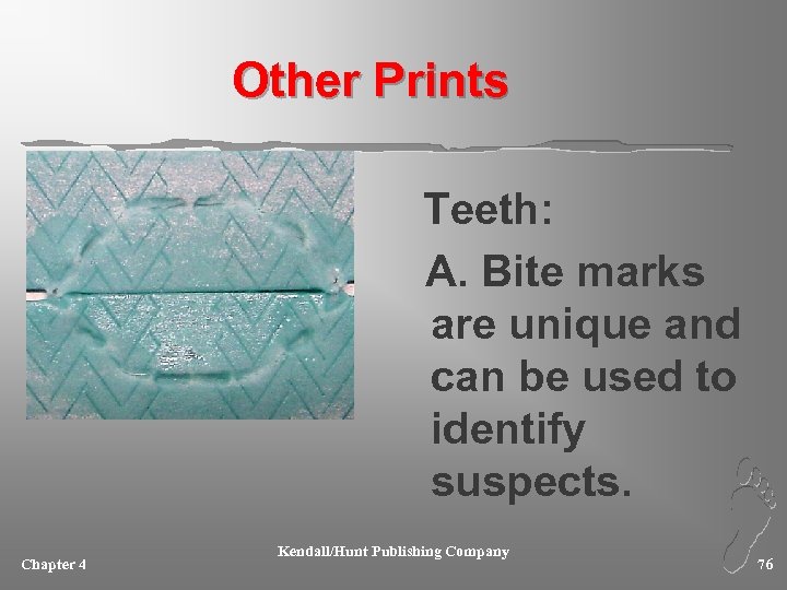 Other Prints Teeth: A. Bite marks are unique and can be used to identify