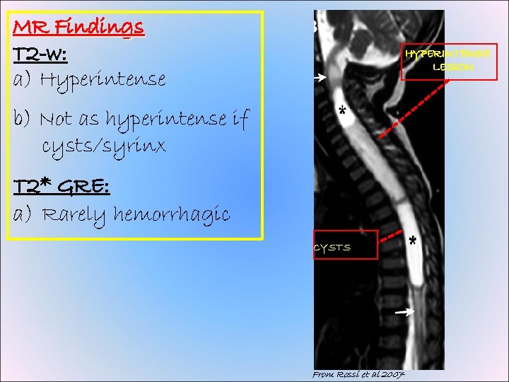 MR Findings T 2 -w: a) Hyperintense HYPERINTENSE LESION b) Not as hyperintense if